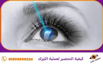 كيفية التحضير لعملية الليزك