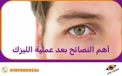 أهم النصائح بعد عملية الليزك