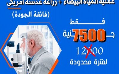 افضل مكان لعمل عملية المياة البيضاء فى الاسكندرية